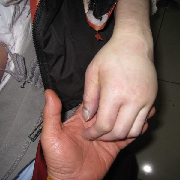 往生助念八小時後手呈現白皙 往生助念八小時後手呈現白皙