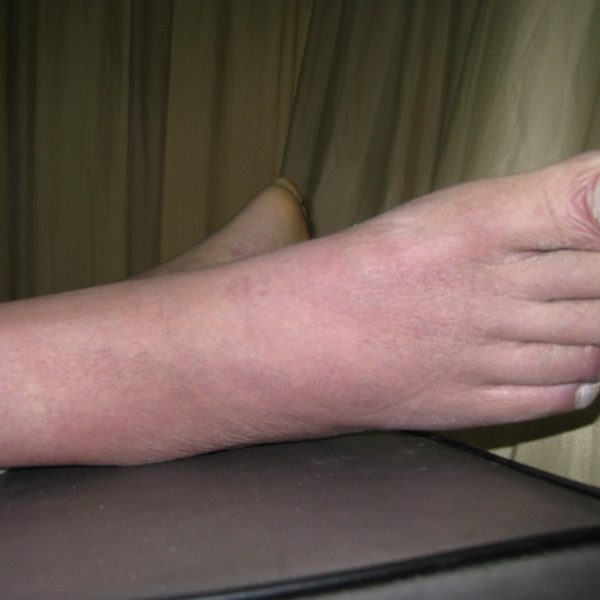 往生助念八小時後腳的顏色恢復正常也不浮腫了 往生助念八小時後腳的顏色恢復正常也不浮腫了